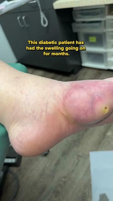 @Deniel Foot and Ankle Center
