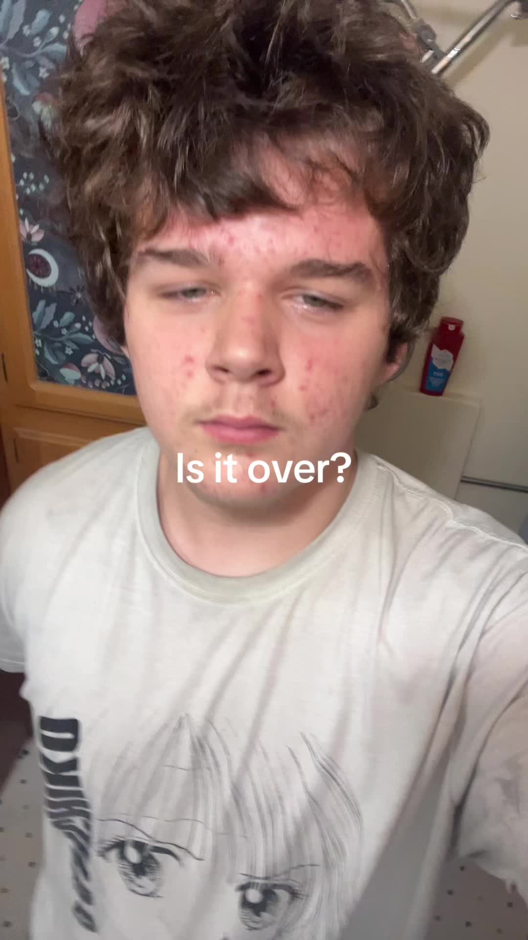 @RE1🪖