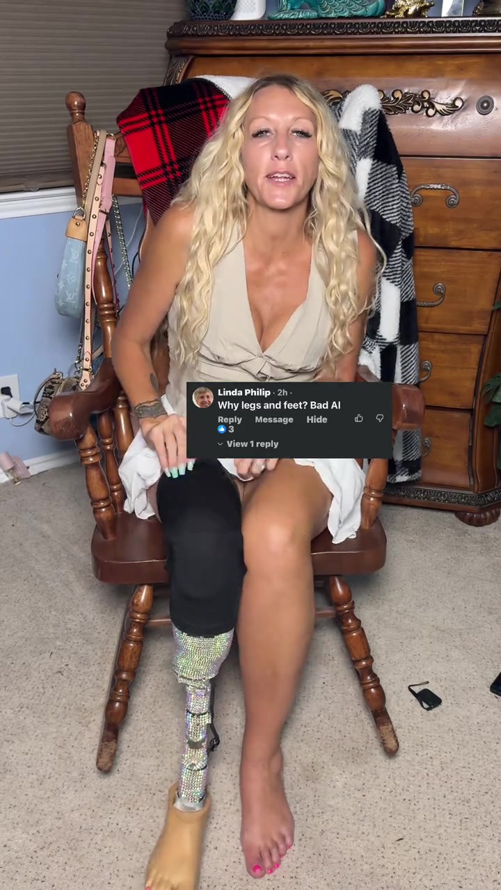 @AmputeeAngie2555