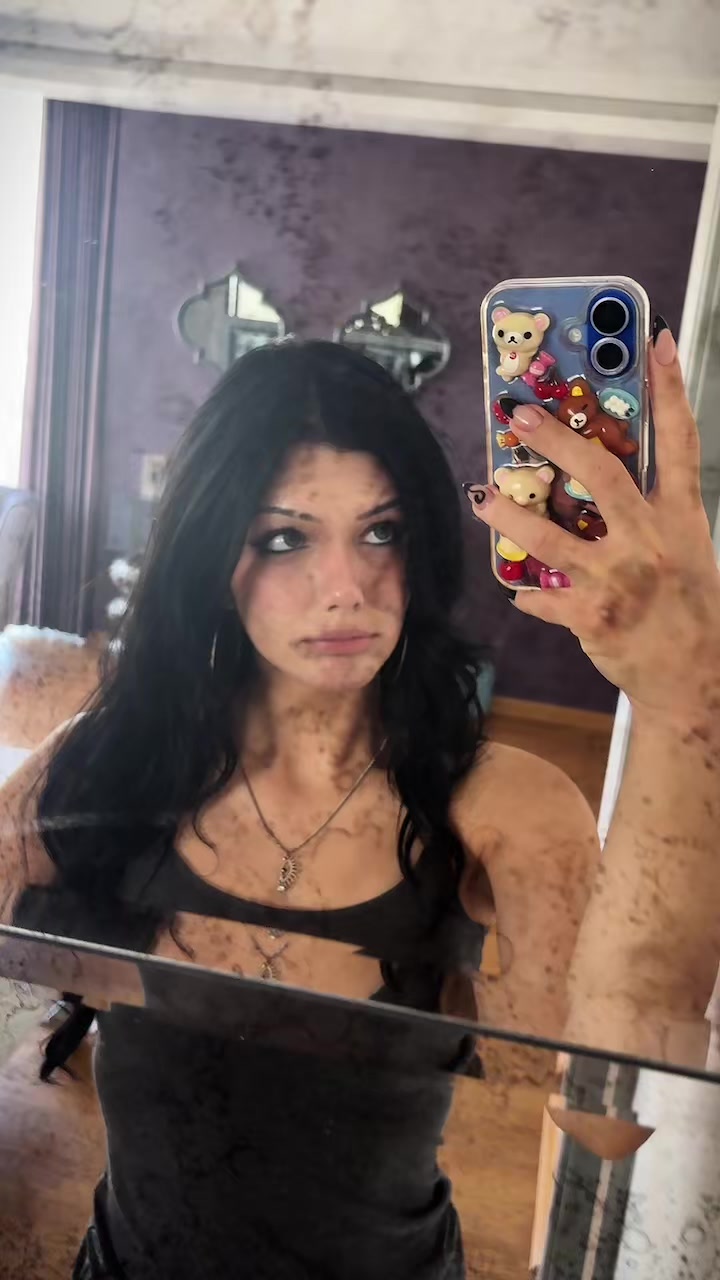 @iris