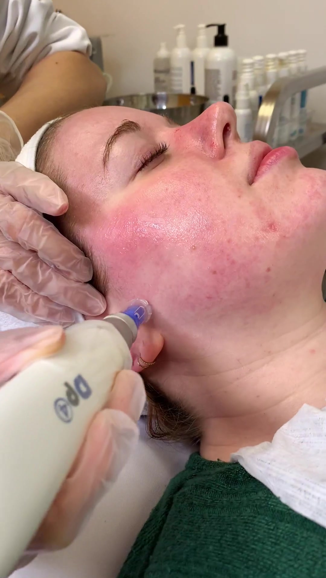 @DermaEnvy Skincare 🇨🇦