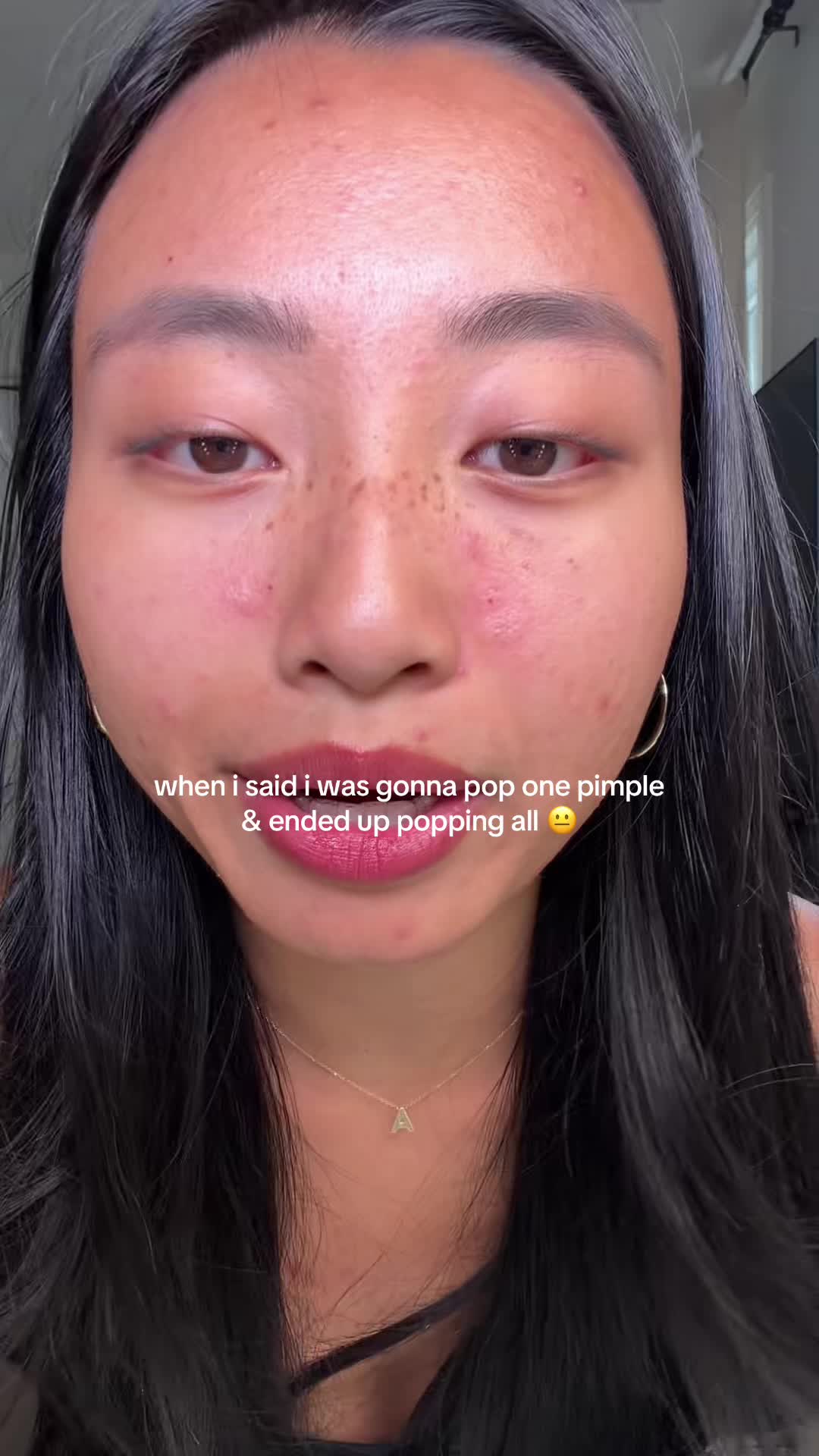 @ALLIE CHEN โ