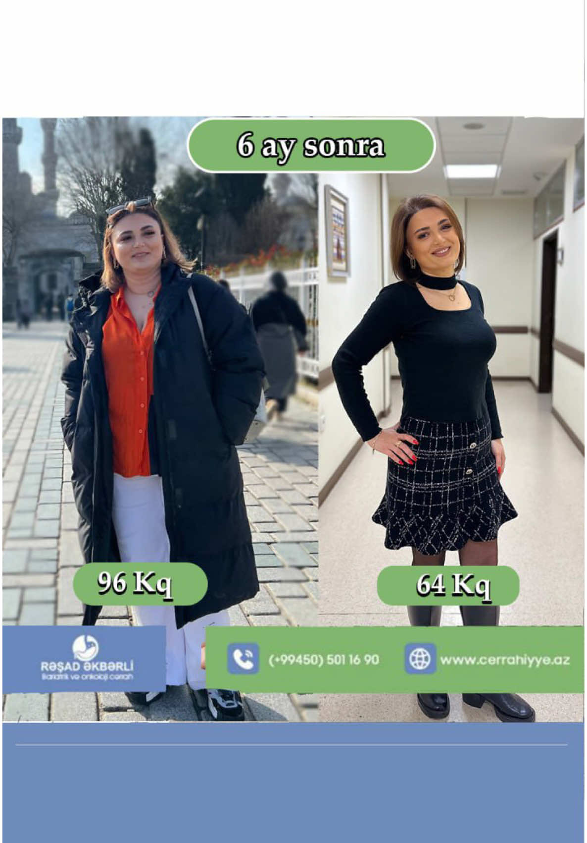 @Ümumi Cərrah Rəşad Əkbərli