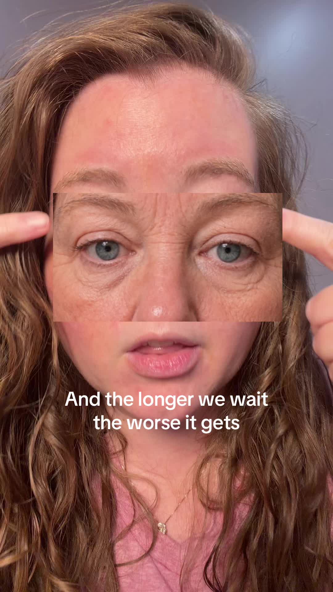 @Robin Lyn Millennial Skin