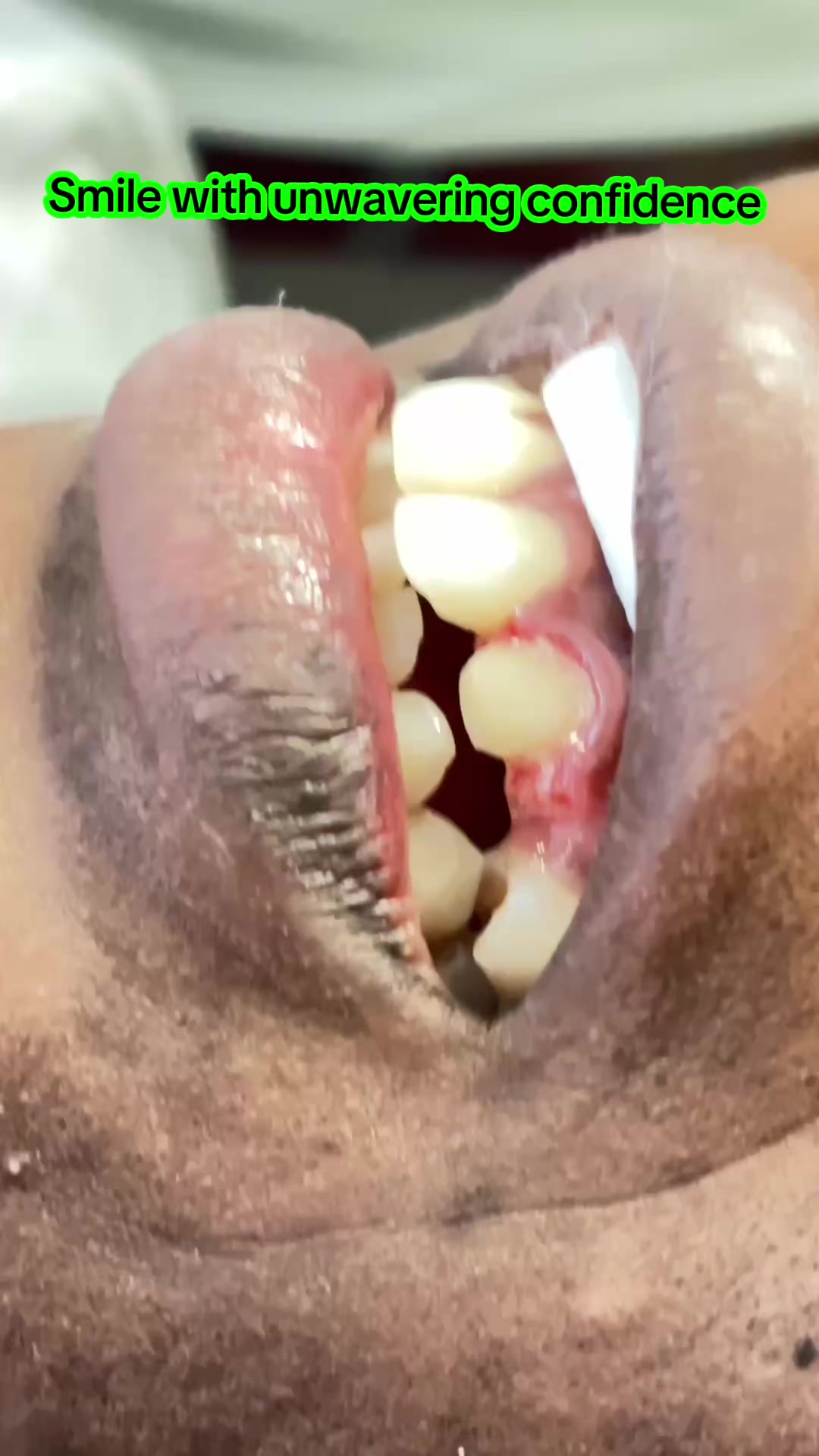 @NGABI DENTISTS 🦷 & Laboratory