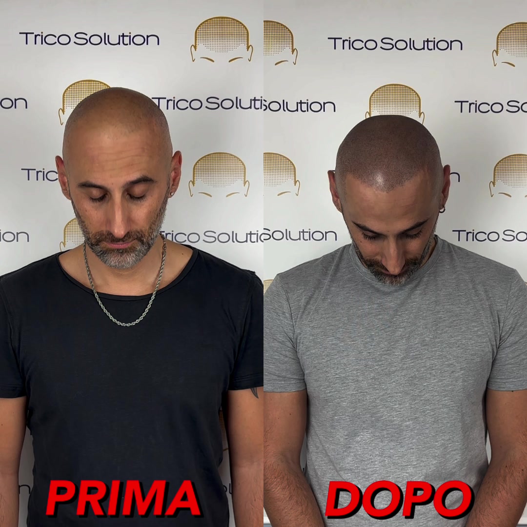 @TricoSolution di Davide Tini