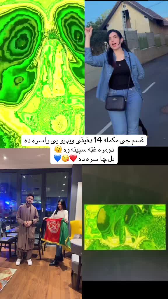 @🥺Ziba 🫠 Ahmadzai 💜💘