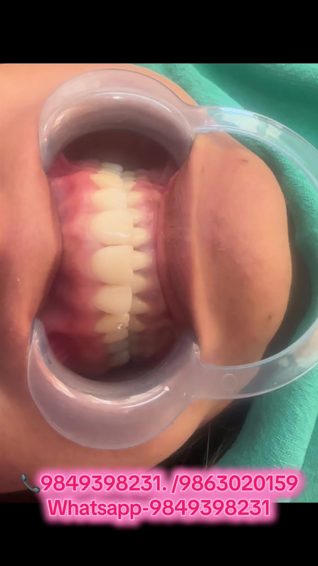 @vaidurya_dental_clinic