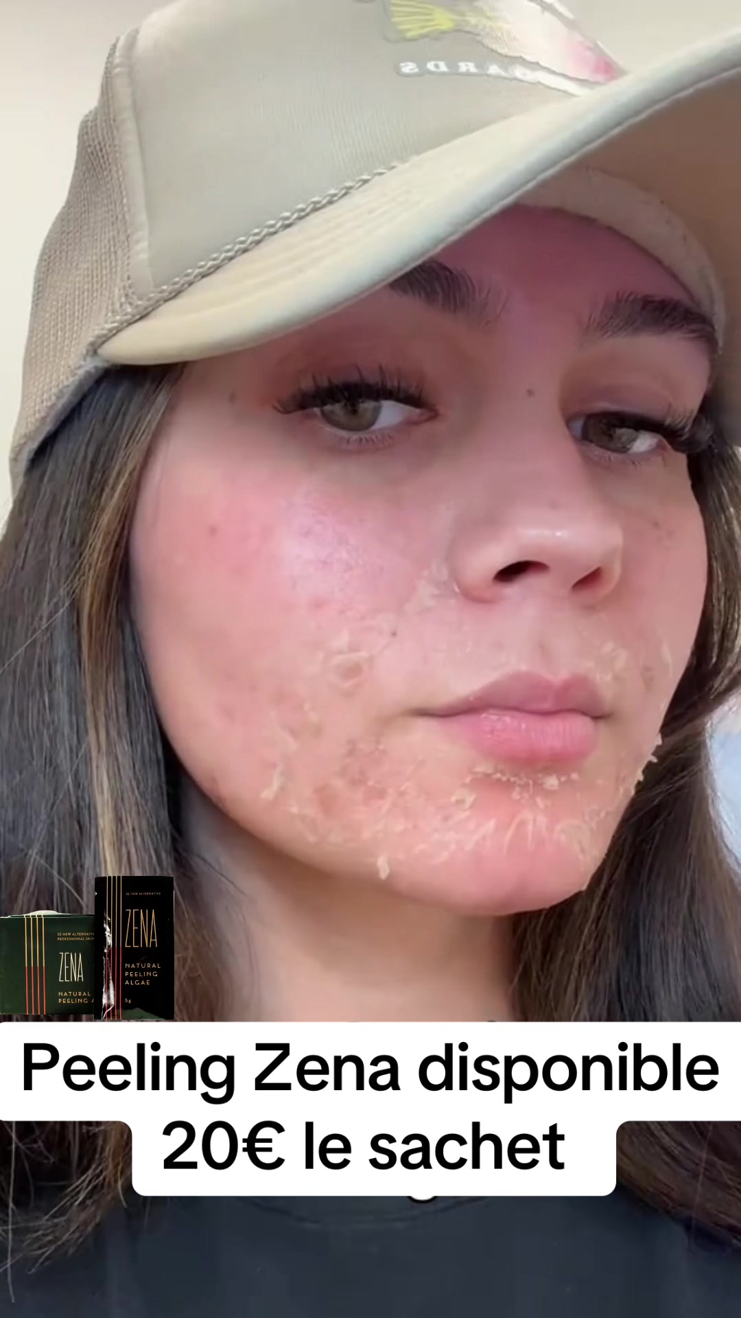 @peeling_zena