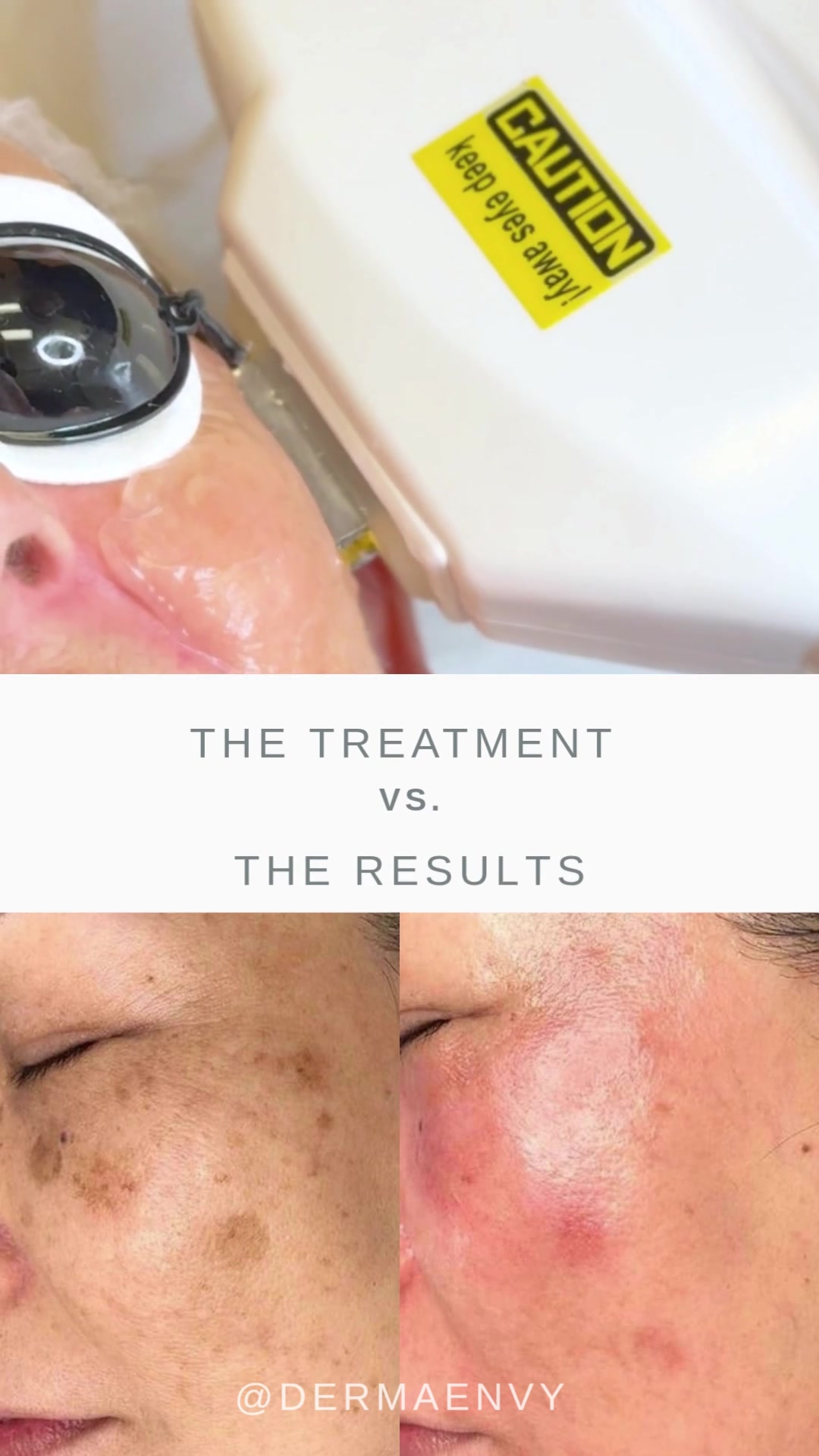 @DermaEnvy Skincare 🇨🇦