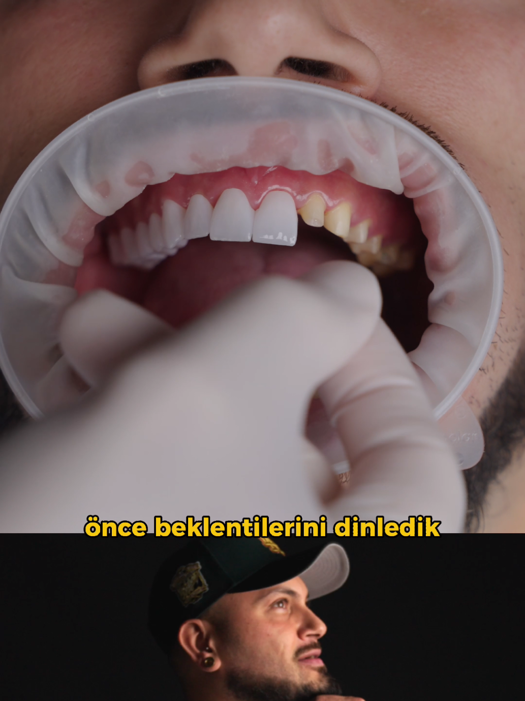 @Doktor Vitrin