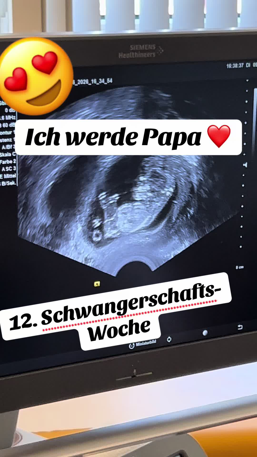 @mc_schleppi