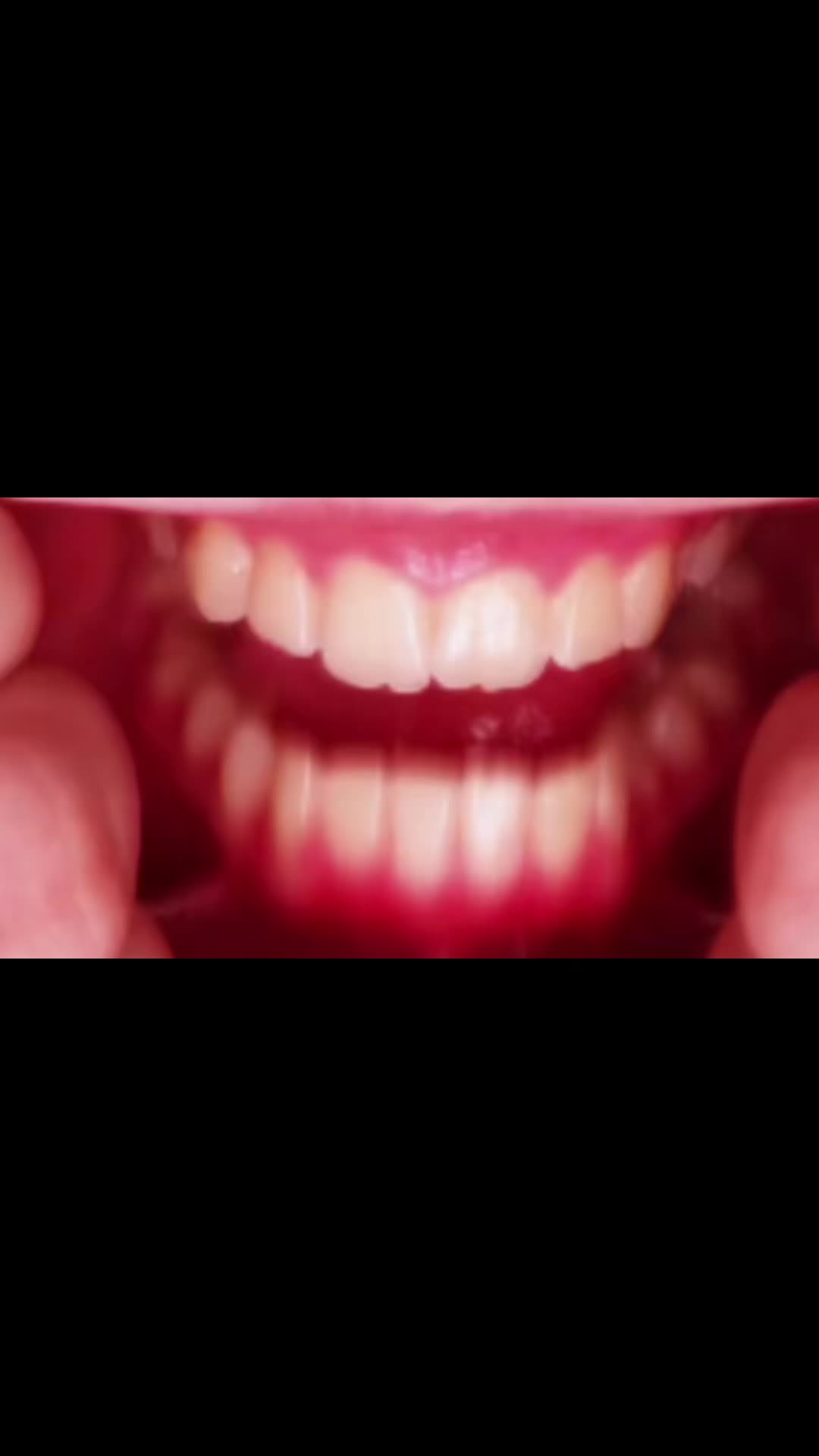 @teeetharecool