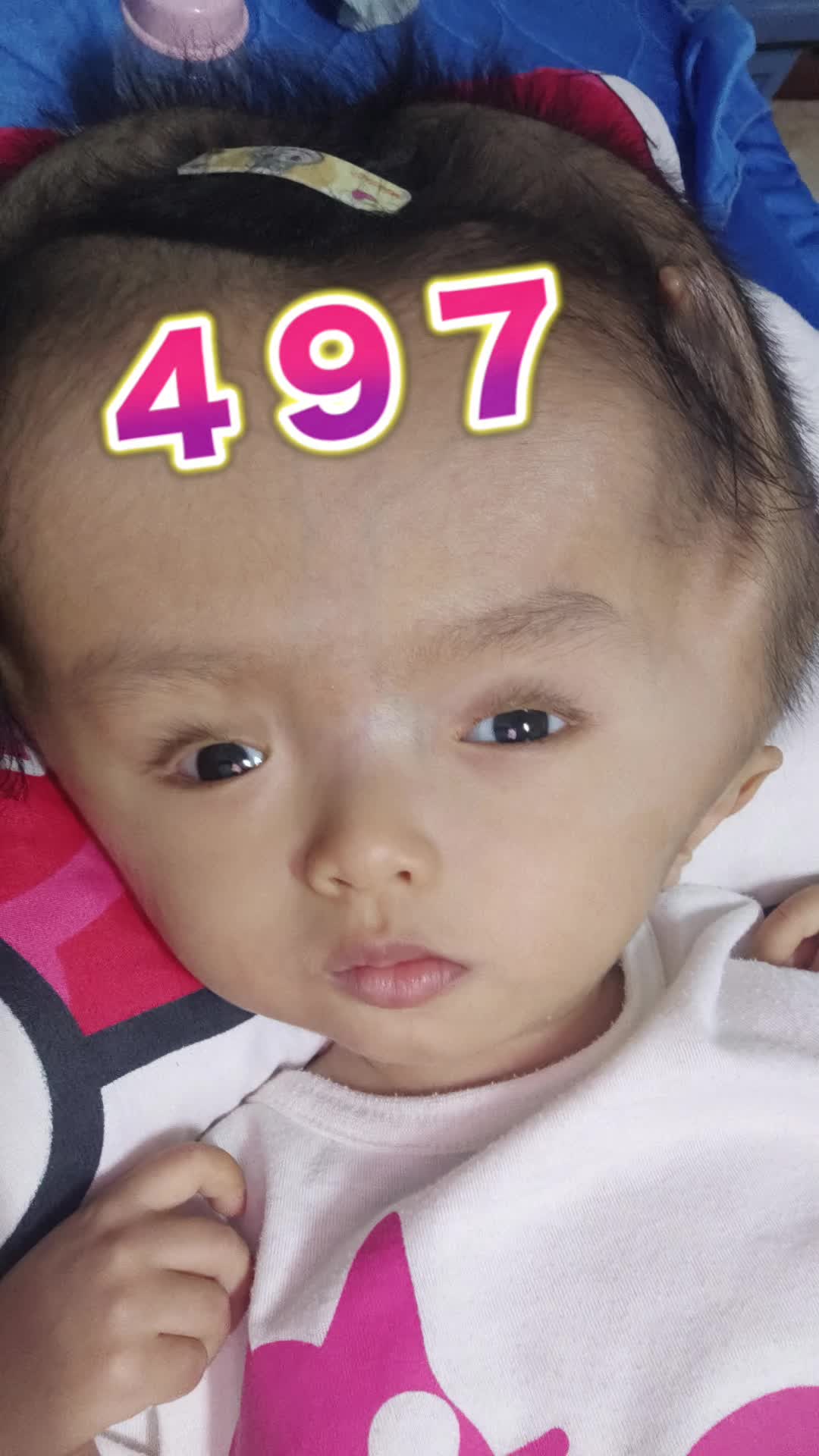 @บู้บี้เด็กหัวโตมีน้ำในโพรงสมอง
