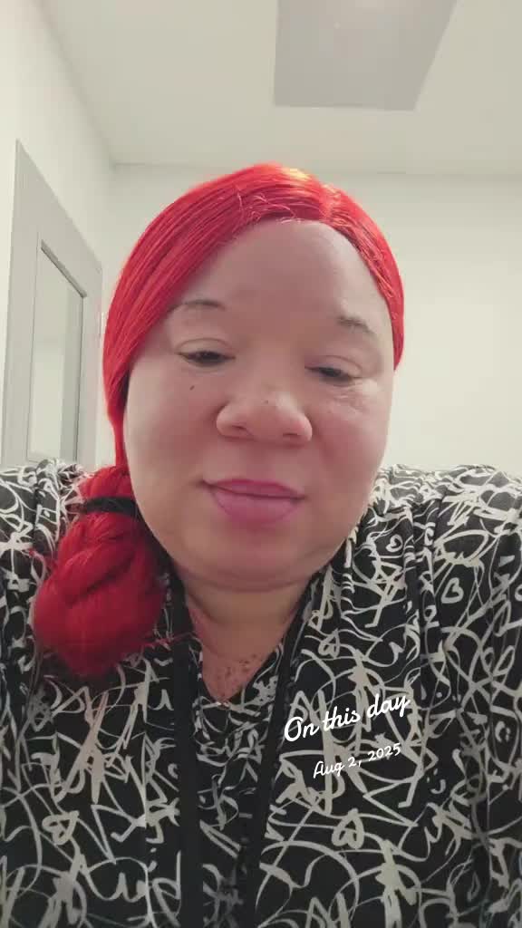 @Miss. PinkY(vitiligo girl)