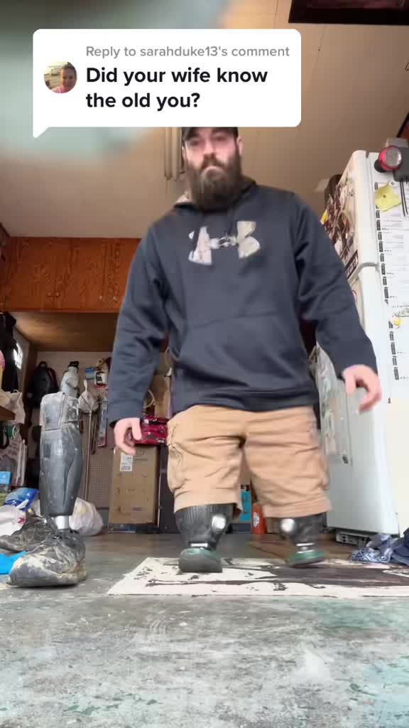 @Limb Loss Boss