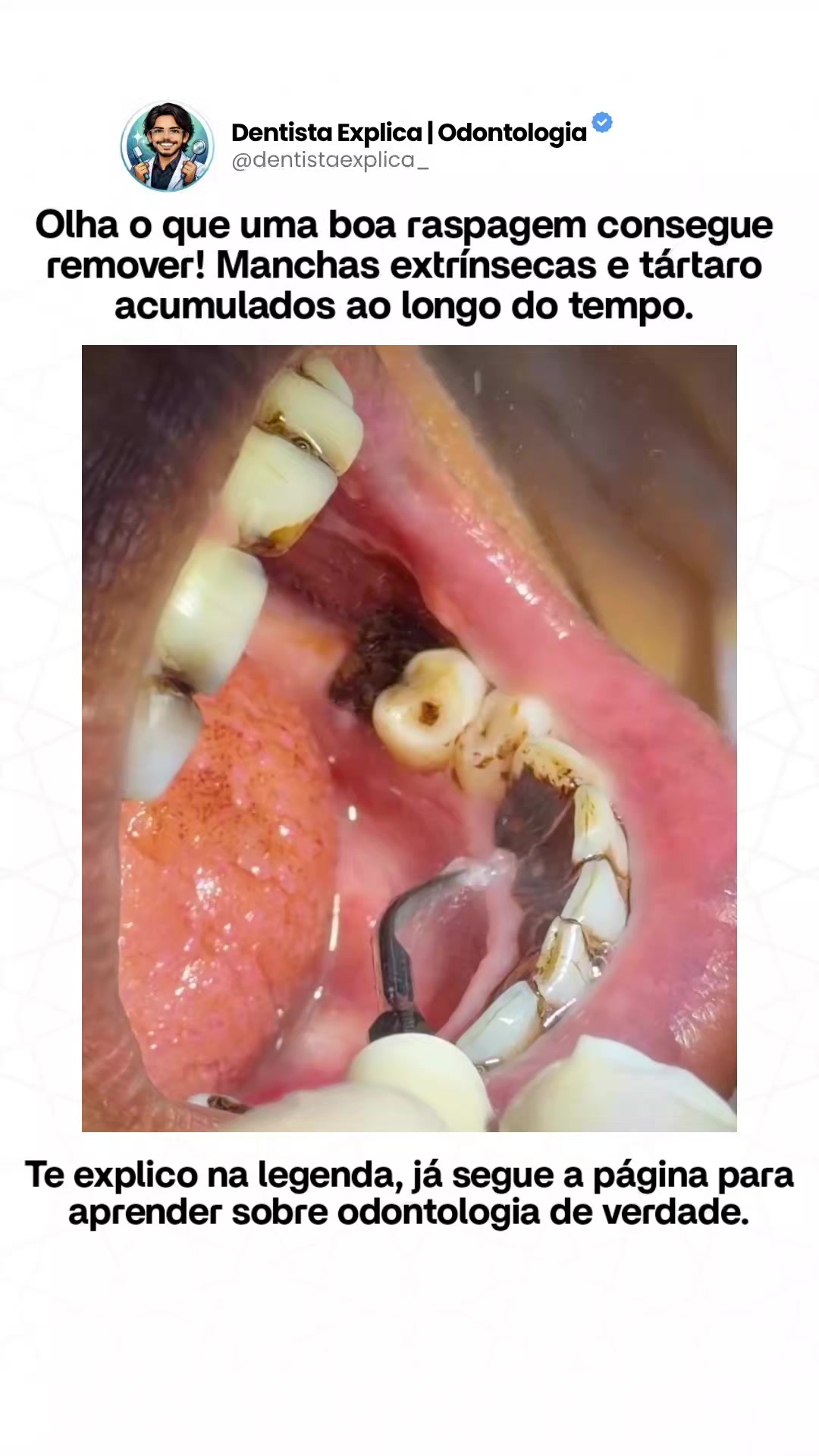 @Dentista Explica | Odontologia