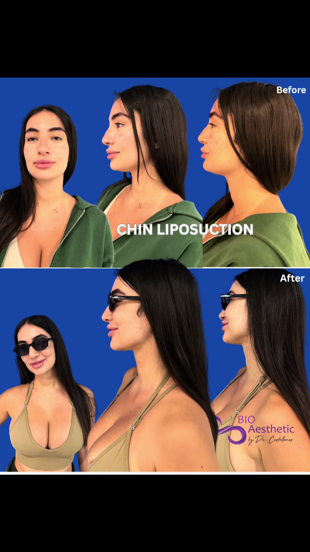 @BioAesthetic305