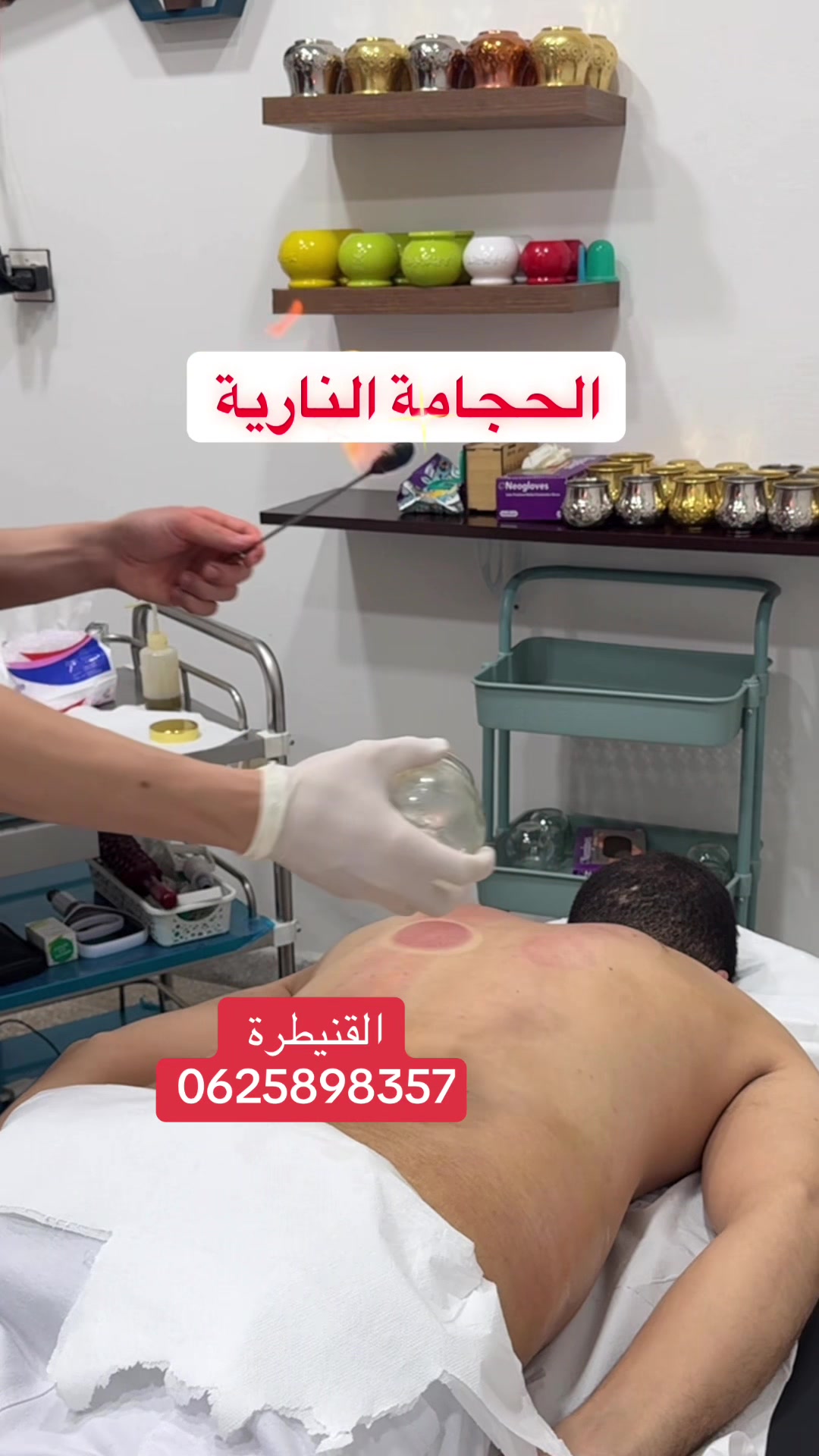 @Hijama.abdelmajid