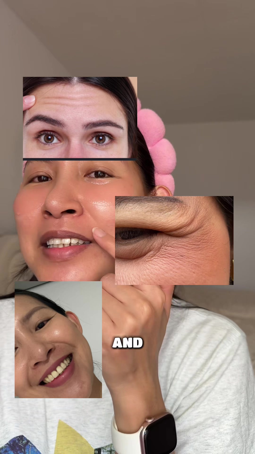 @storyofanacnefighter