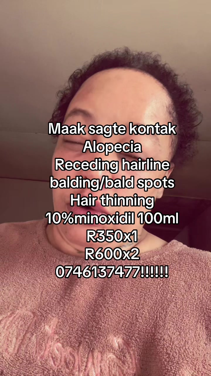 @Bless kop meisi