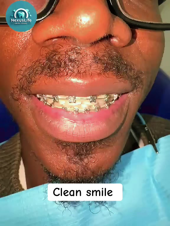 @NEXUSLIFE DENTAL CLINIC🦷