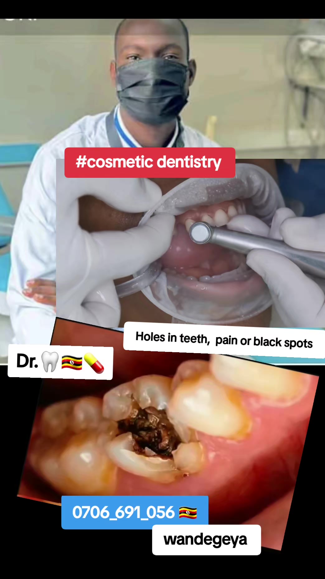 @Dental studio.🦷.Kampala