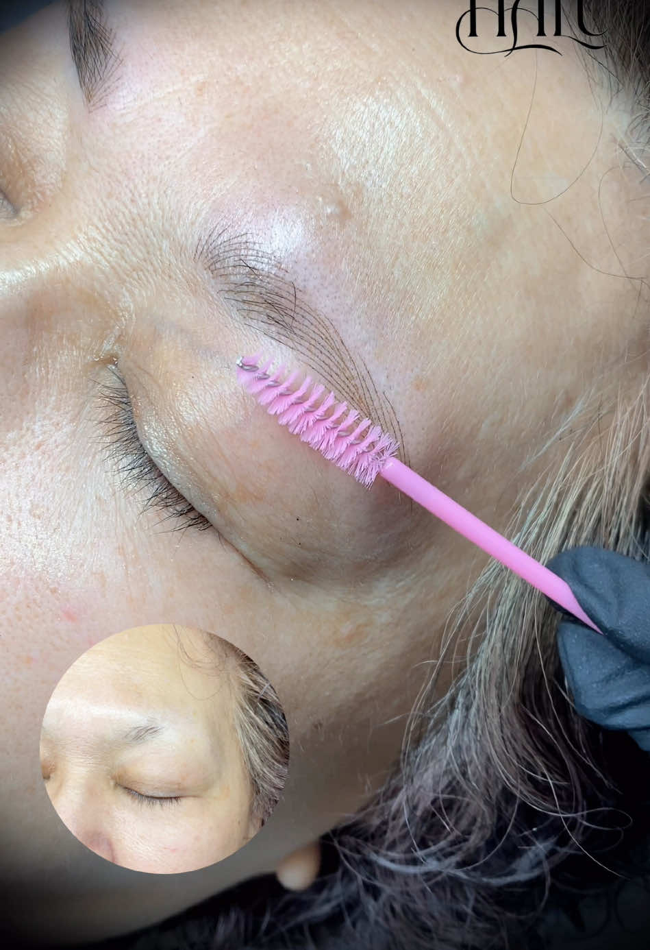 @MIWOO_CLINIC 大阪院