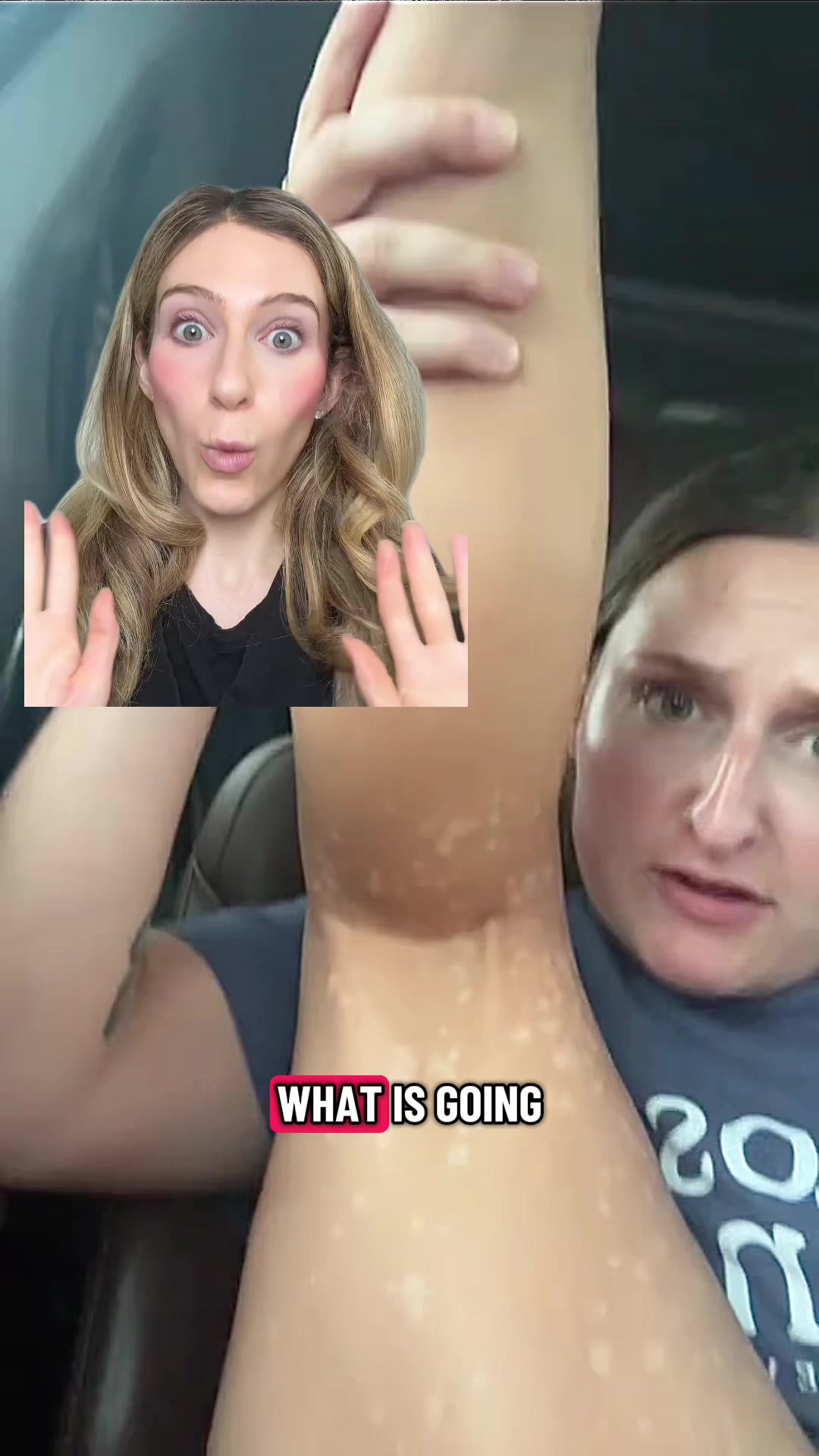 @Heather Kornmehl, MD