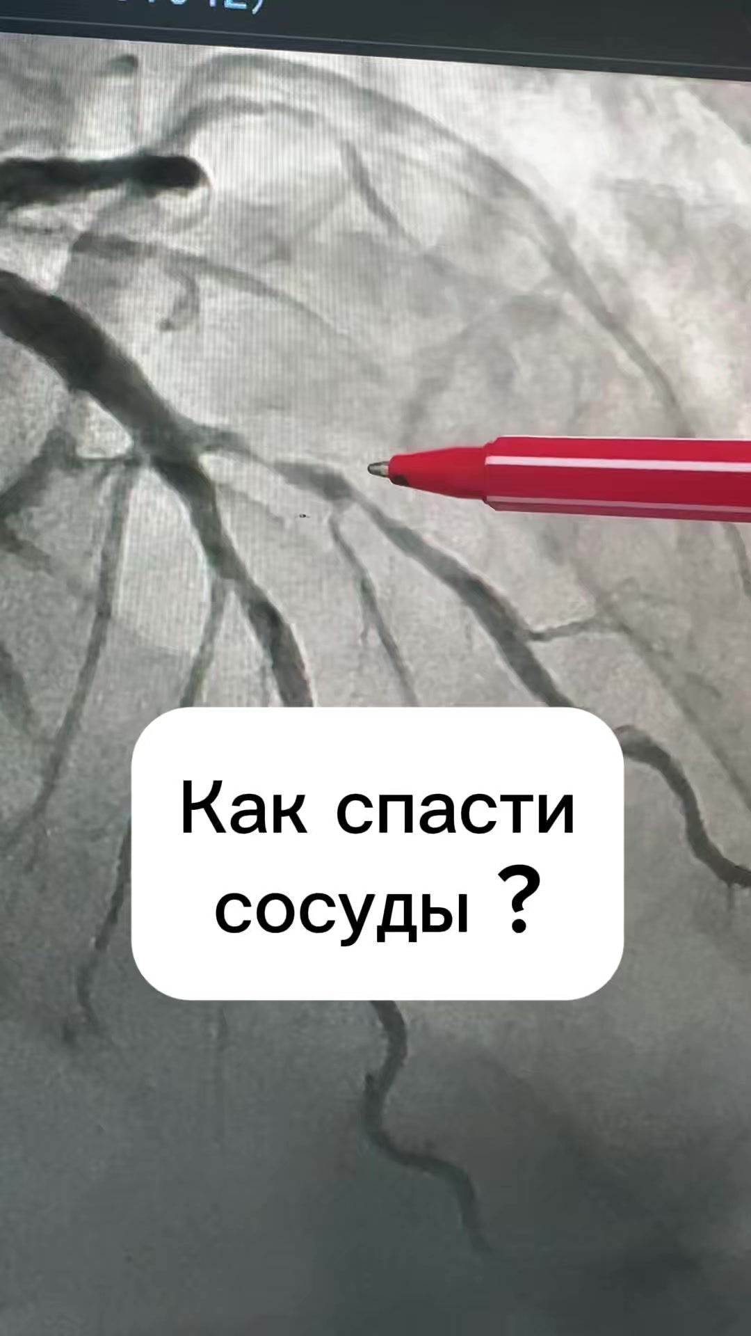 @Кардиолог / Аспет