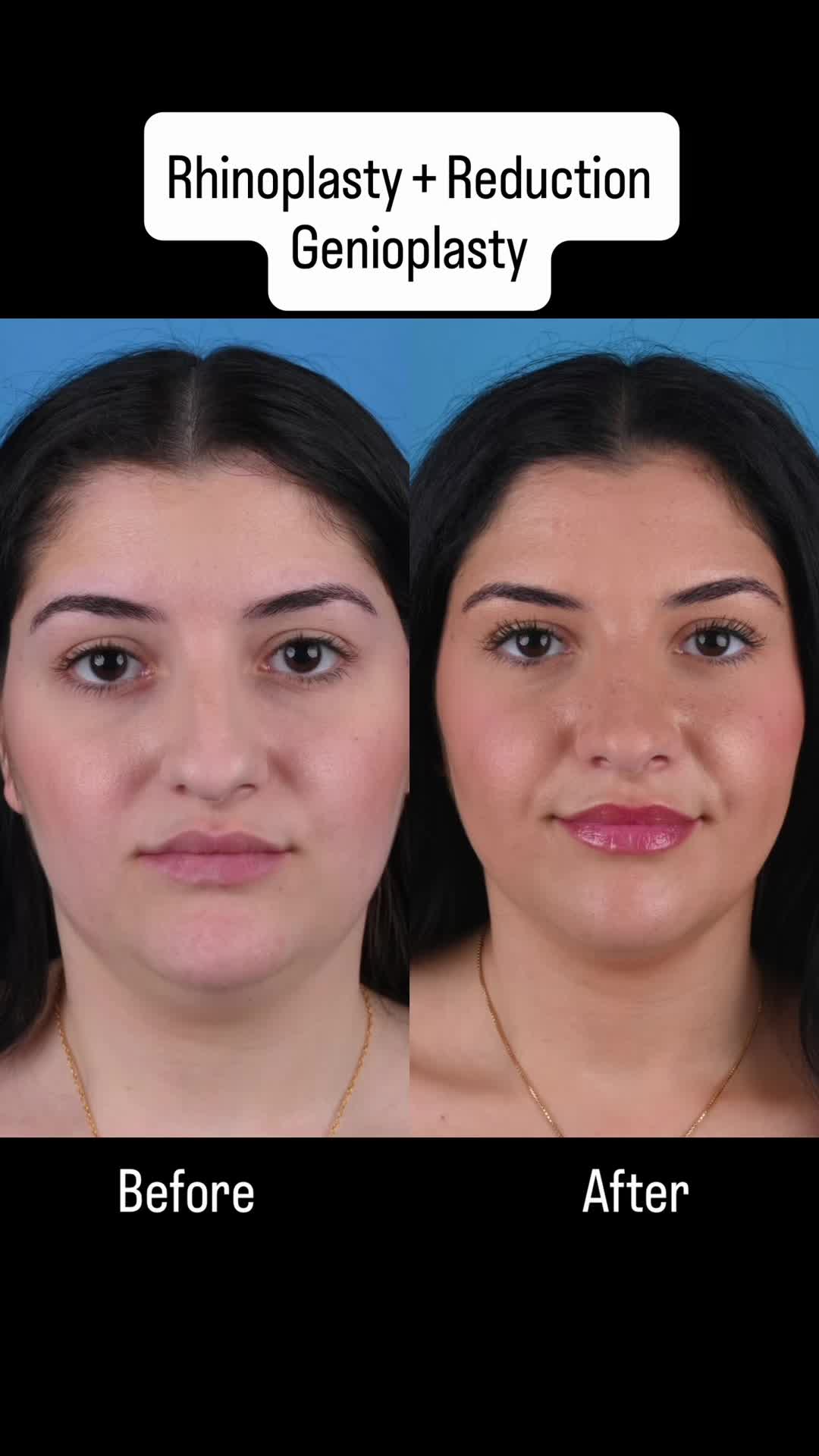 @Dr. Parit Patel, MD