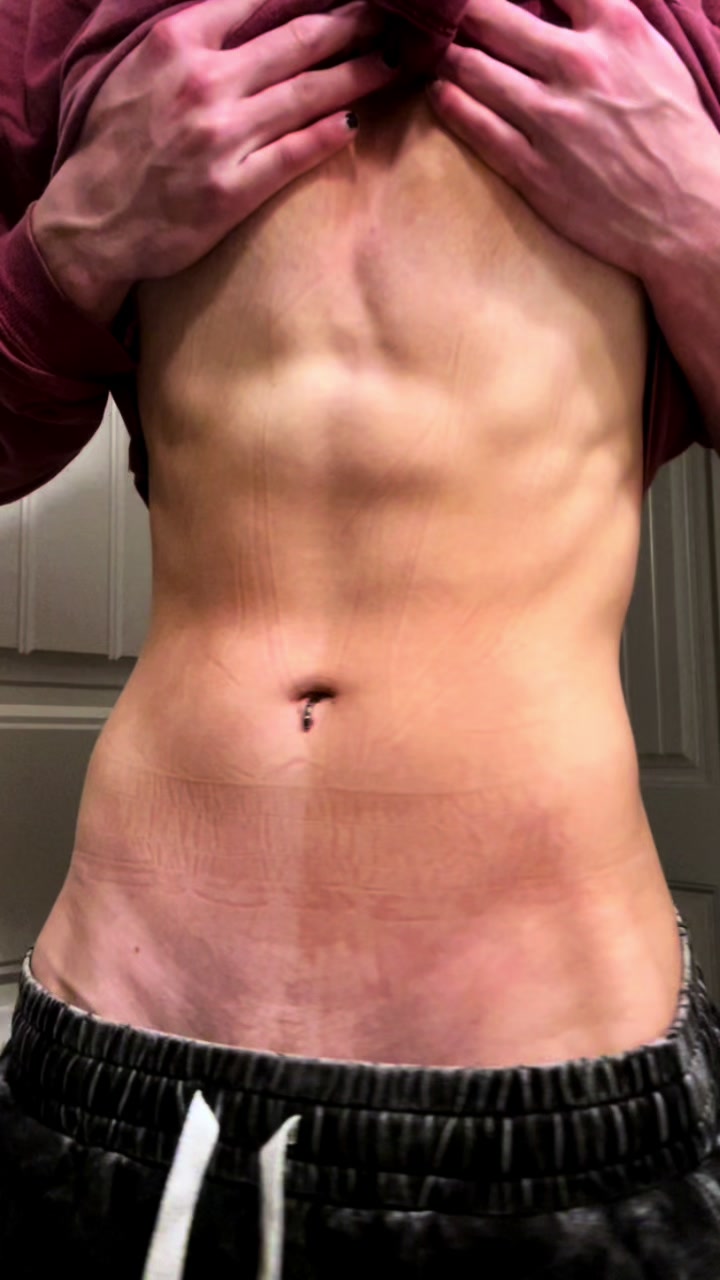 @soft.bruise