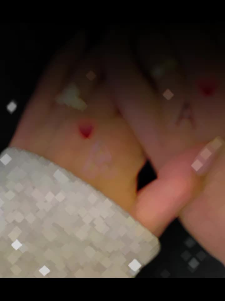 @🎀 A ❤️🩹