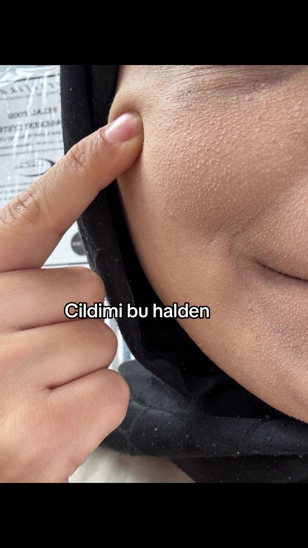 @Yussii