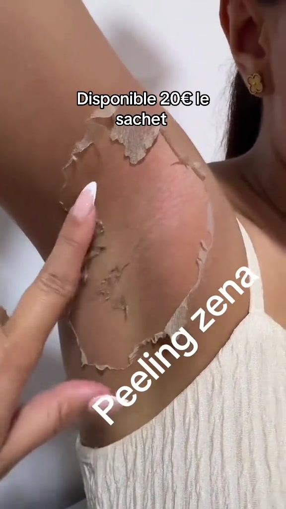 @peeling_zena