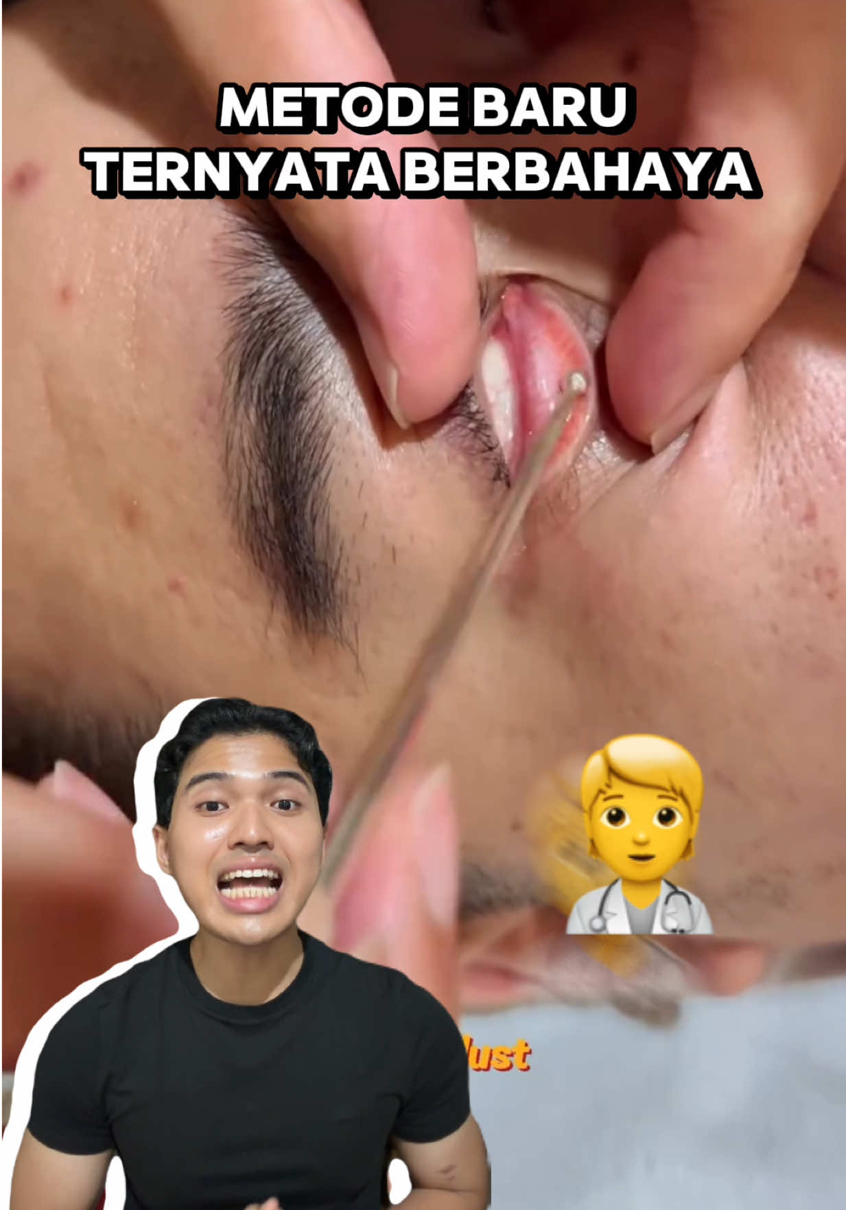 @Ekida