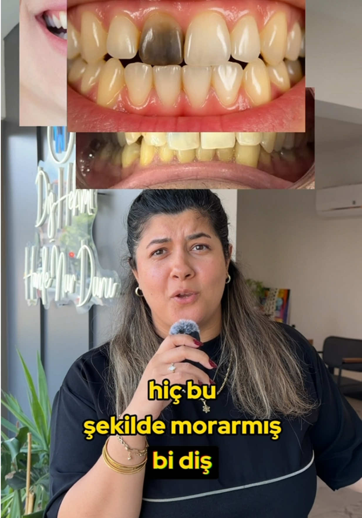 @Diş Hekimi Handenur Duru