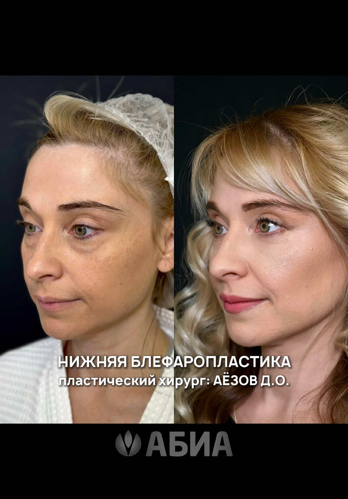 @АБИА
