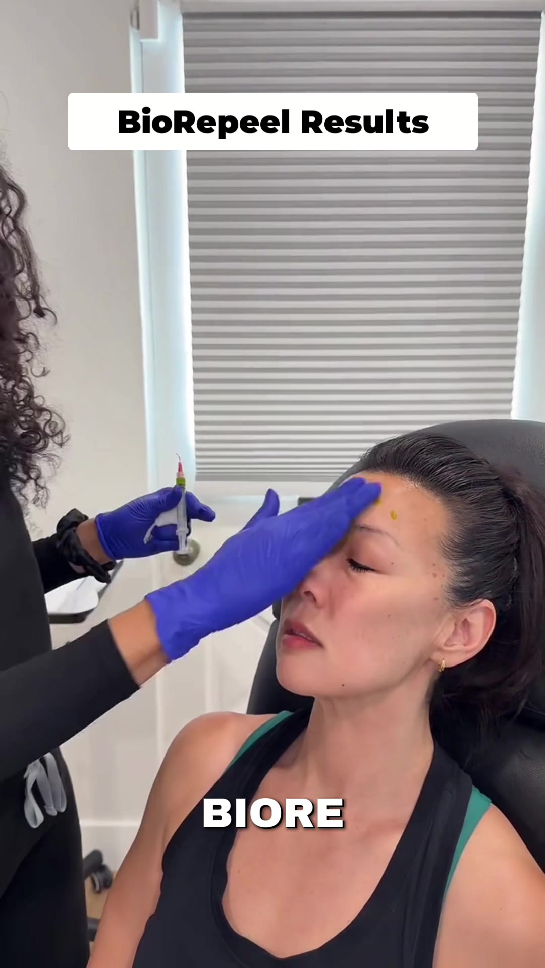 @Botox Filler Skin Los Angeles