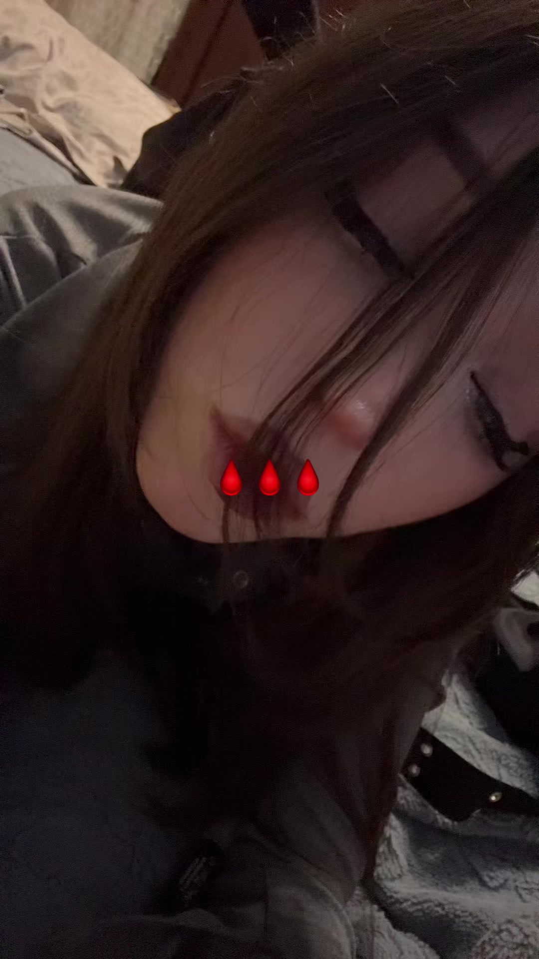 @тгк:bes1sonova