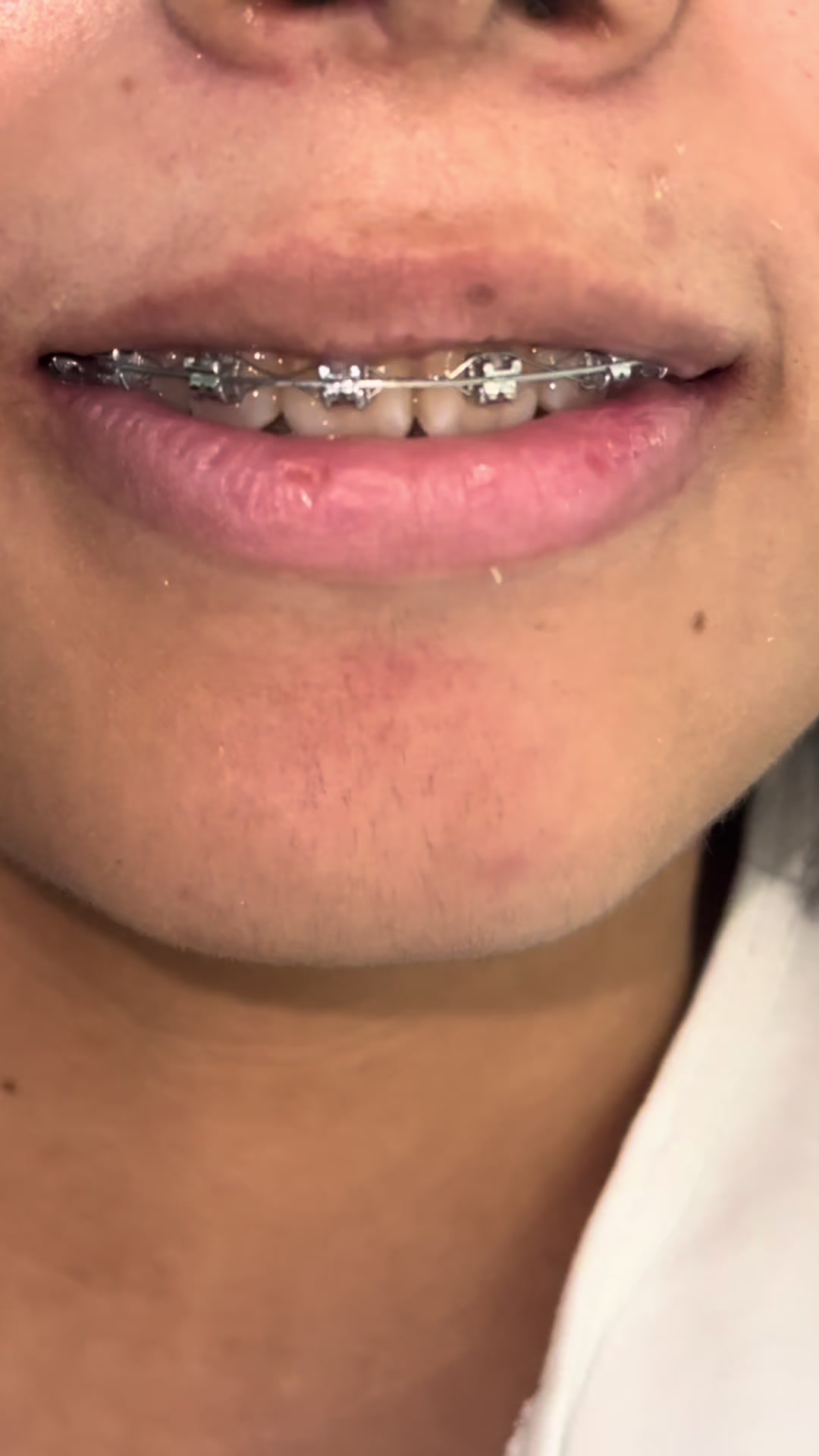 @Dr. Juan Perez | Ortodoncista