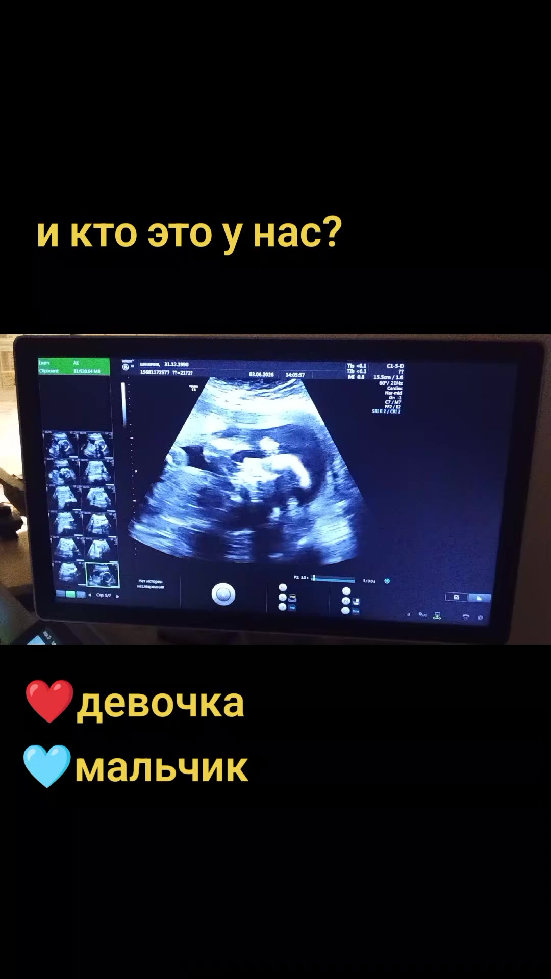 @Juliya Isambetova