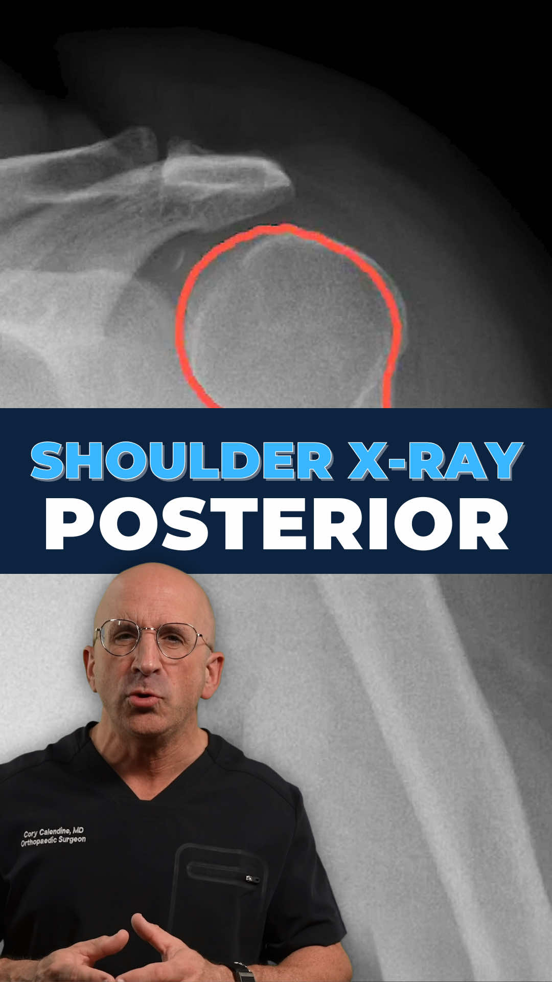 @Bone Doctor - Joint Pain MD