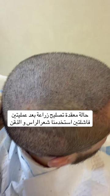 @Dr. Ahmed Alkhateeb