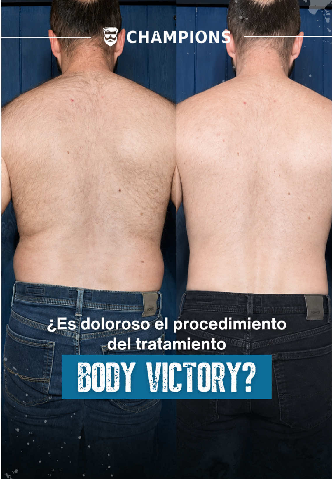 @Champions.men