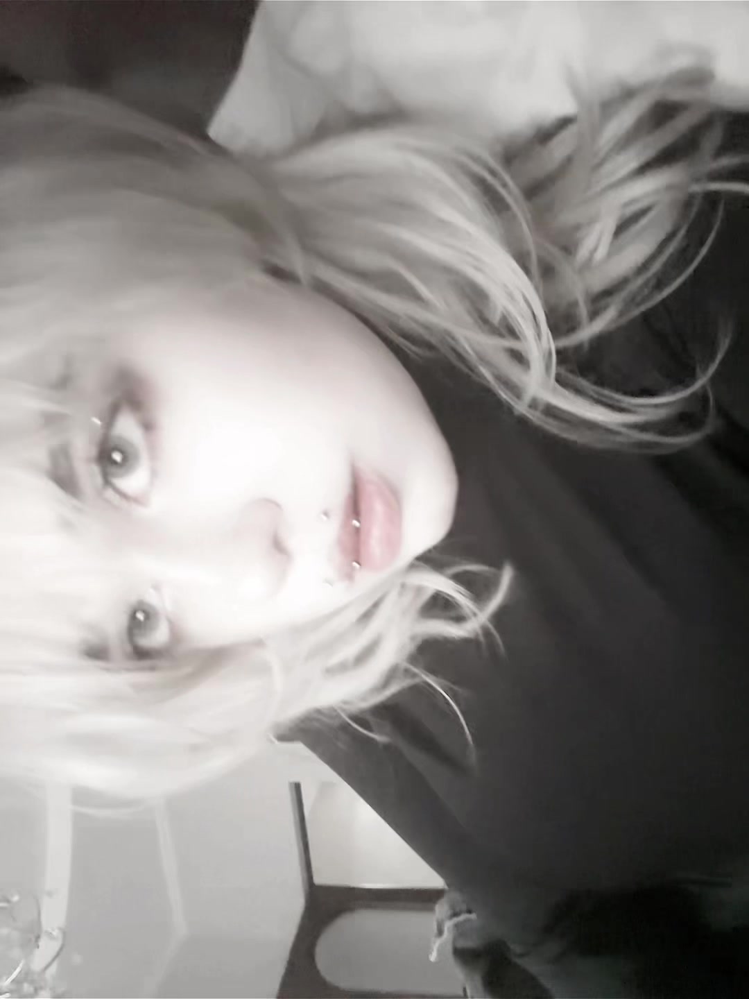 @uglyrosis