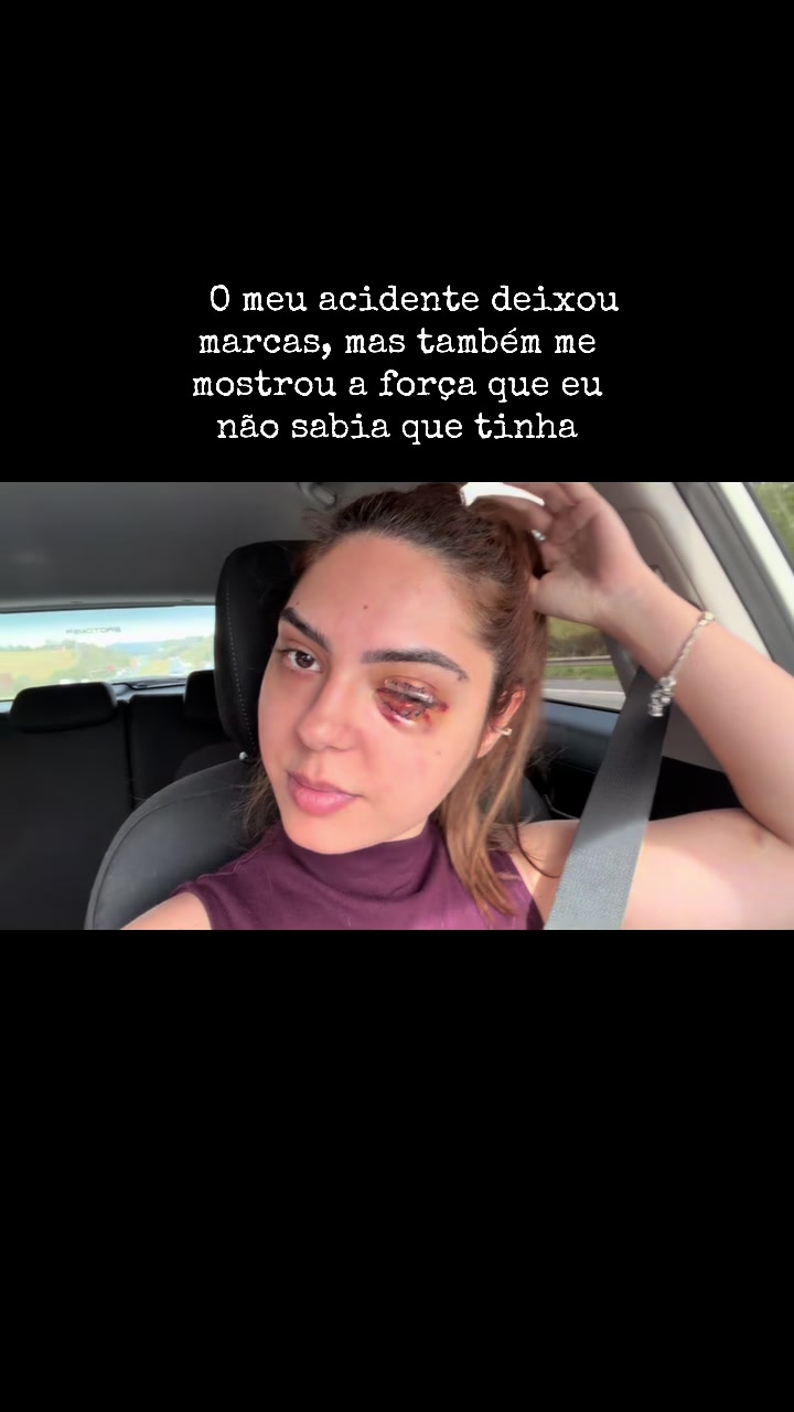 @Gabi Mendon&ccedil;a
