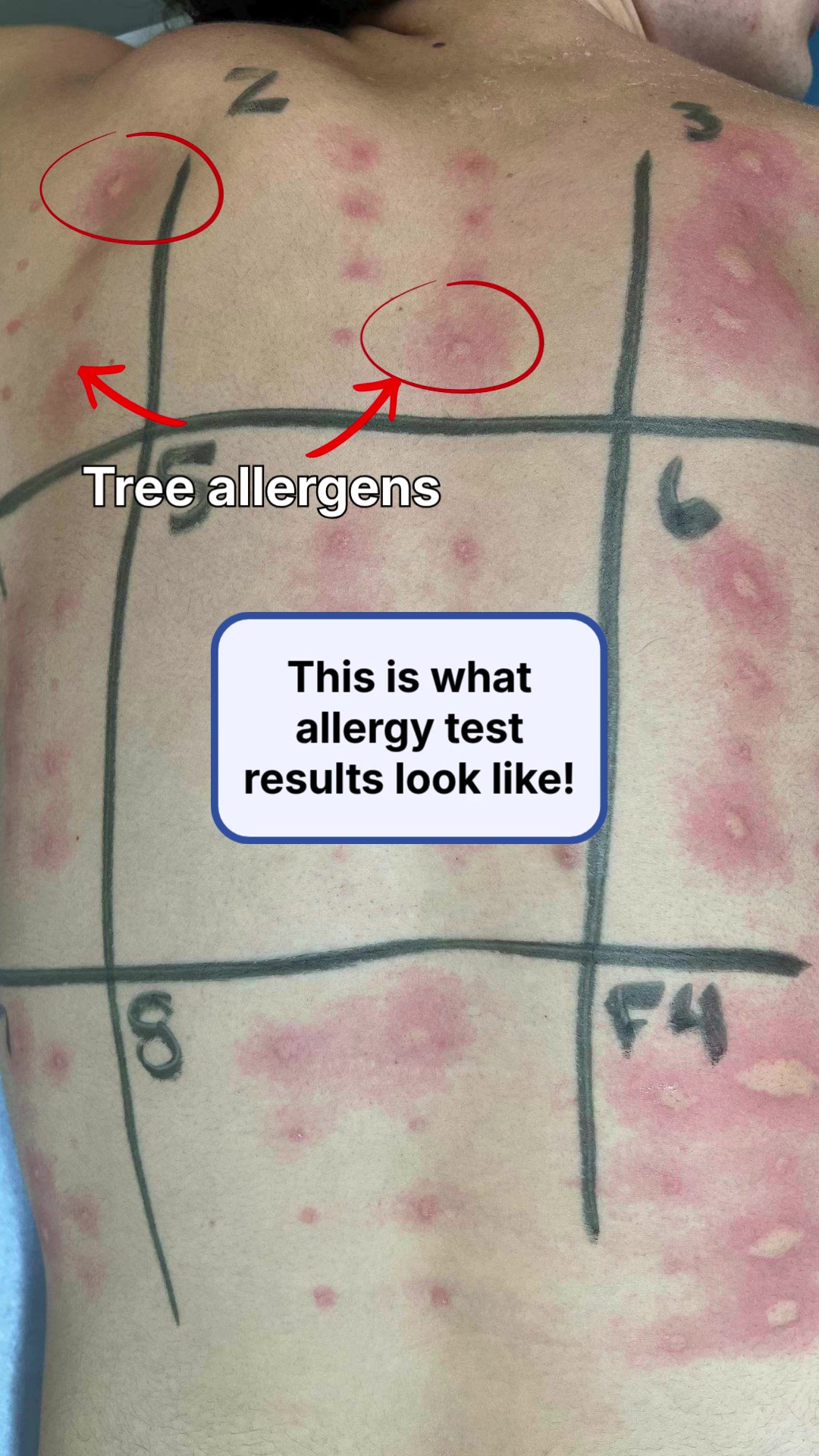 @OhioENTandAllergy