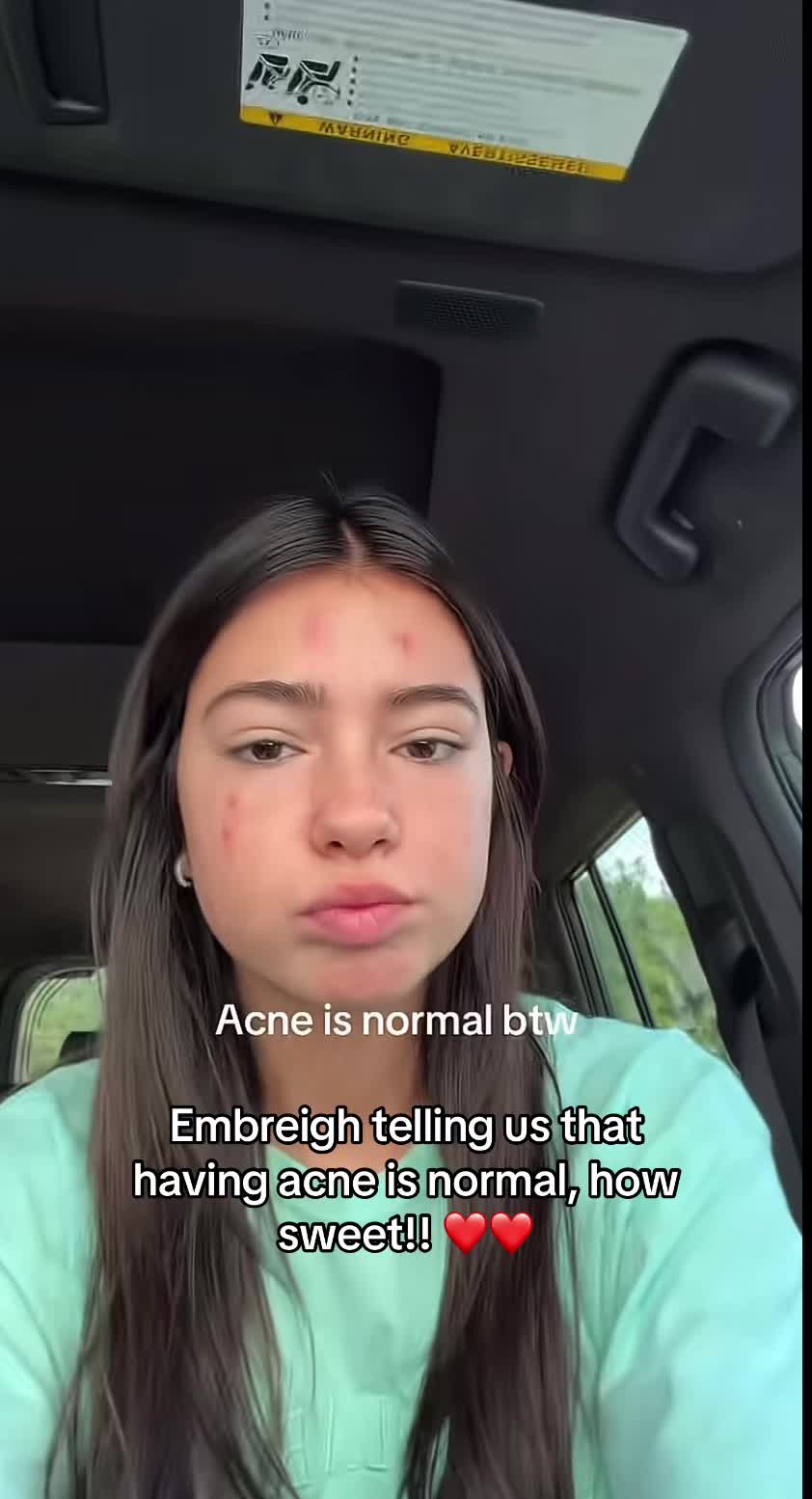 @gurl ๐
๐
