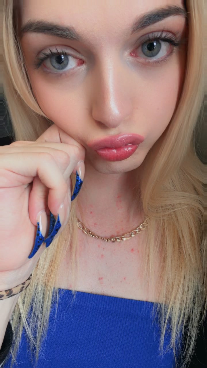 @Patzdoll